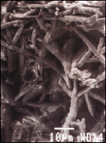 SEM photo of gypsum crystals