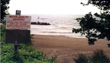 Photograph showing typical posting of a beach water-quality advisory for high bacteria levels