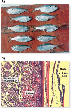 Photographs
of A - ulcerative mycosis
of menhaden, and B - 
microscopic appearance of
ulcers illustrating the invasive
fungal hyphae and chronic
inflammatory response
within muscle tissue