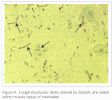 Figure 4. Fungal structures, darkly stained by Grocott, are visible within muscle tissue of menhaden.