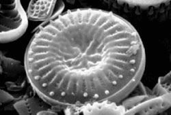 photograph of lake diatom, under intense magnification