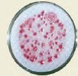 Photograph showing a plate culture of Clostridium perfringens on mCP agar.