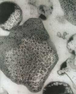 photograph of archael bacteria