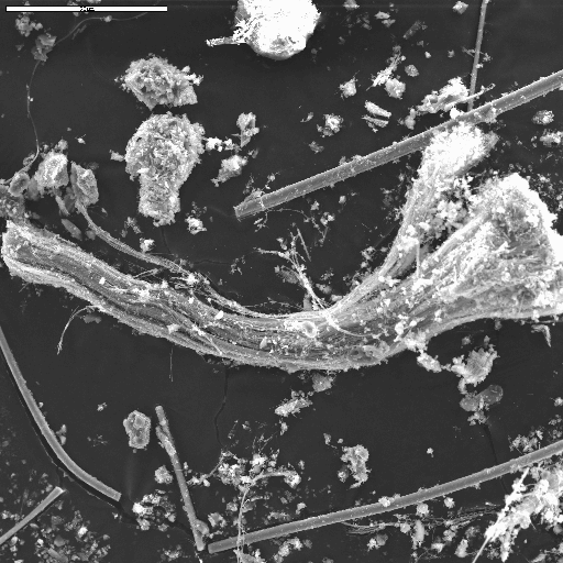 SEM image of a chrysotile bundle and glass fibers from sample 8