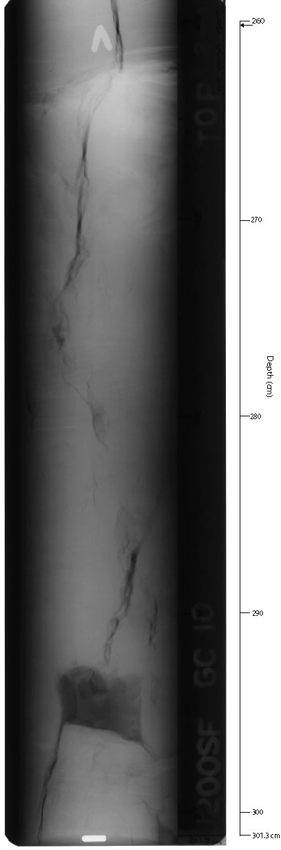 X-ray of GC-10sec8.