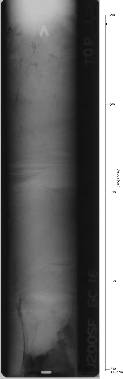 X-ray of GC-16sec9.
