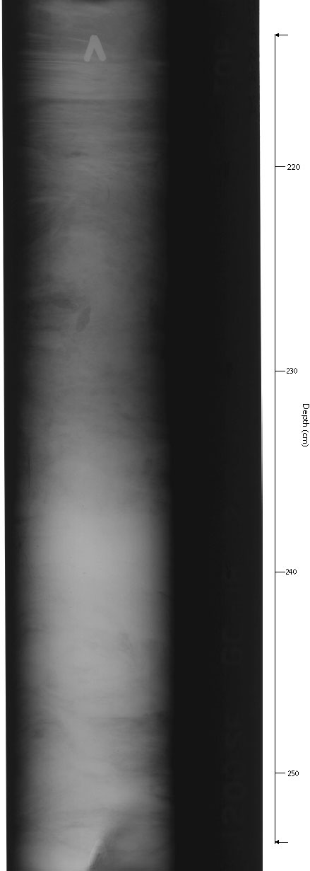 X-ray of GC-18sec7.
