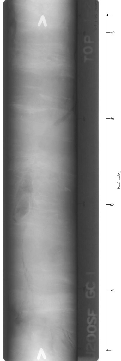 X-ray of GC-1sec2.