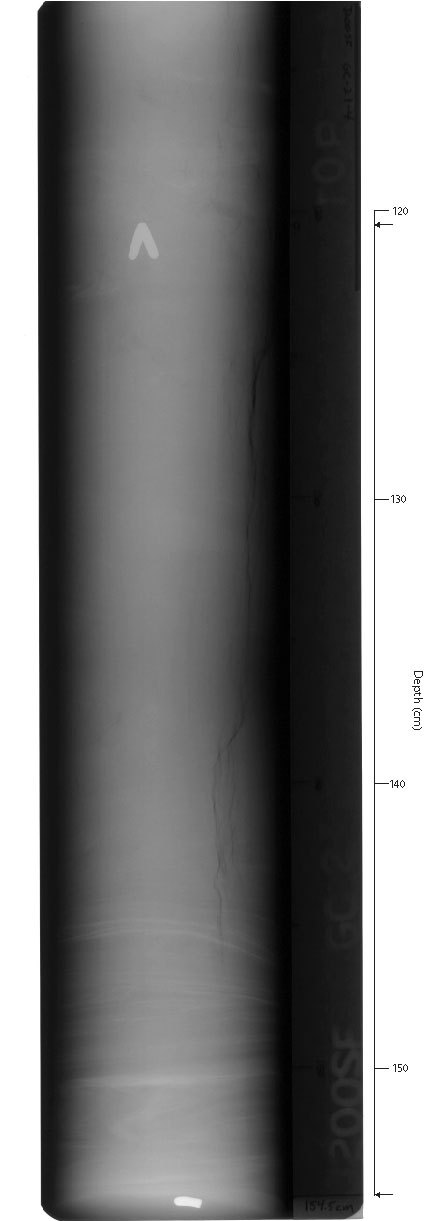 X-ray of GC-2sec4.