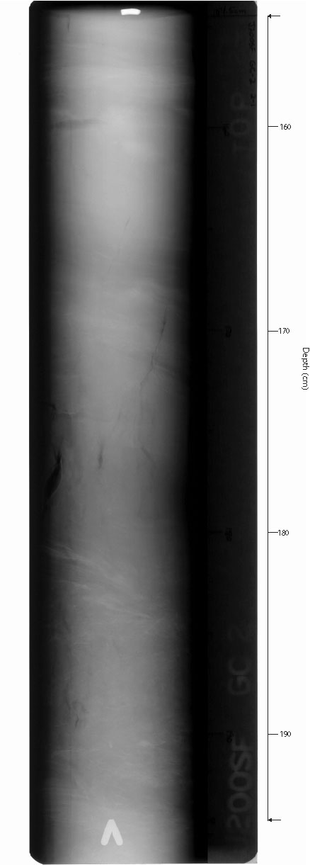 X-ray of GC-2sec5.