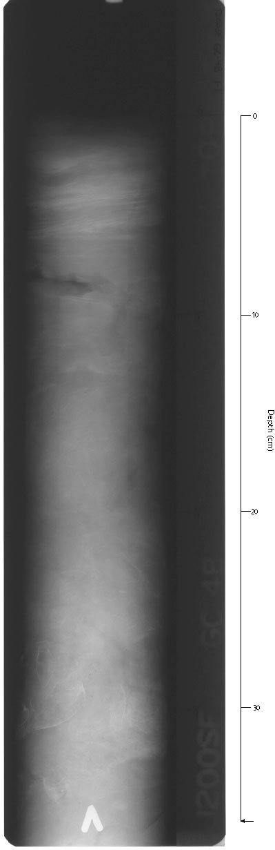 X-ray of GC-4Bsec1.