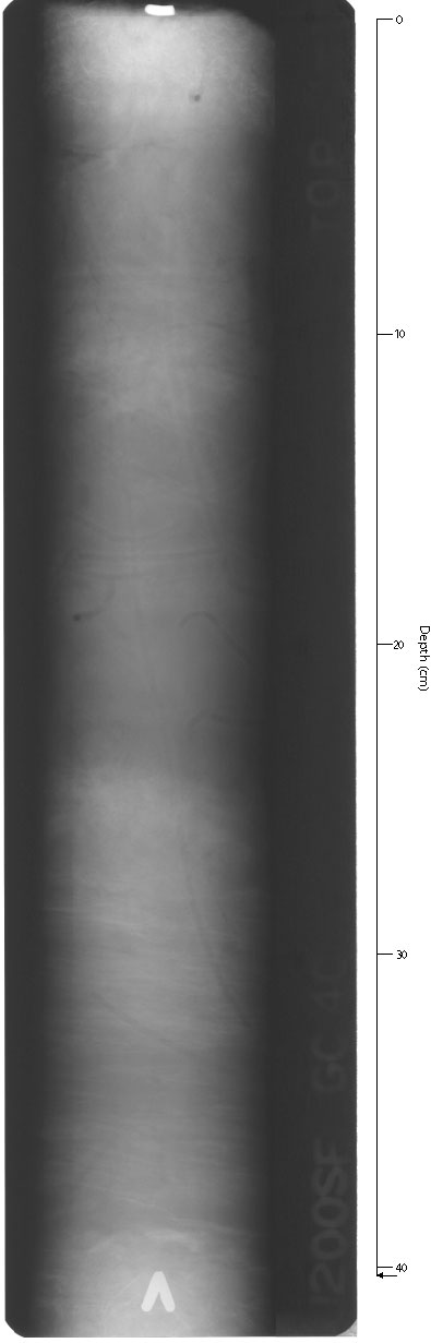 X-ray of GC-4Csec1.