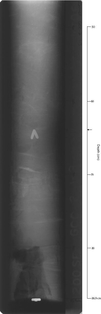 X-ray of GCC-2sec3.
