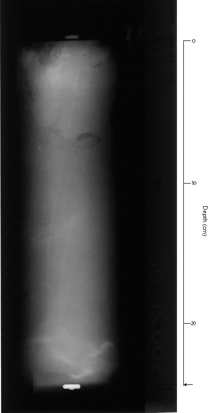 X-ray of GCC-3Asec1.