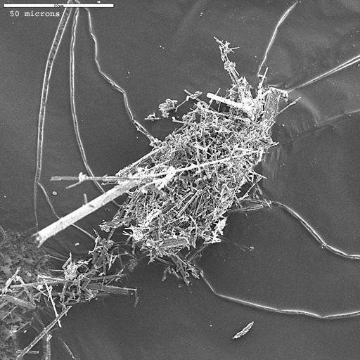 Figure 8a.  A cluster of amphibole fibers