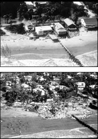 Figure 1.1. Photographs of the beach at Folly Island taken before and after Hurricane Hugo.