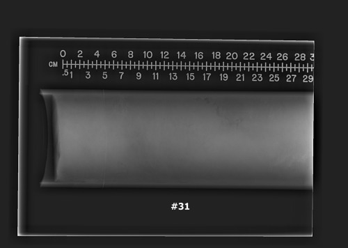 Thumbnail image for Figure 5: example of core radiograph.